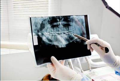 Esami e screening orali albania dental aesthetic