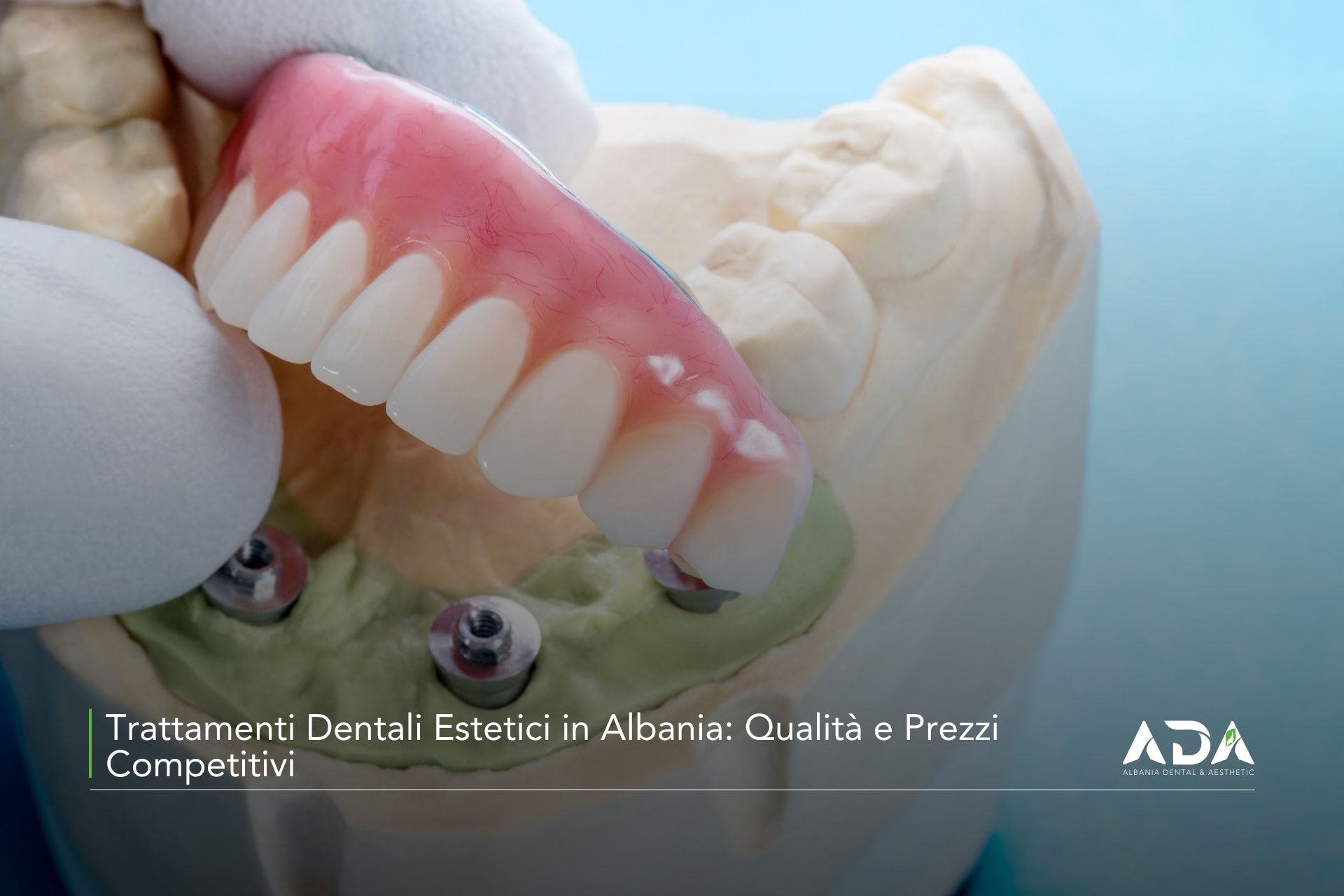 Trattamenti Dentali Estetici in Albania: Qualità e Prezzi Competitivi